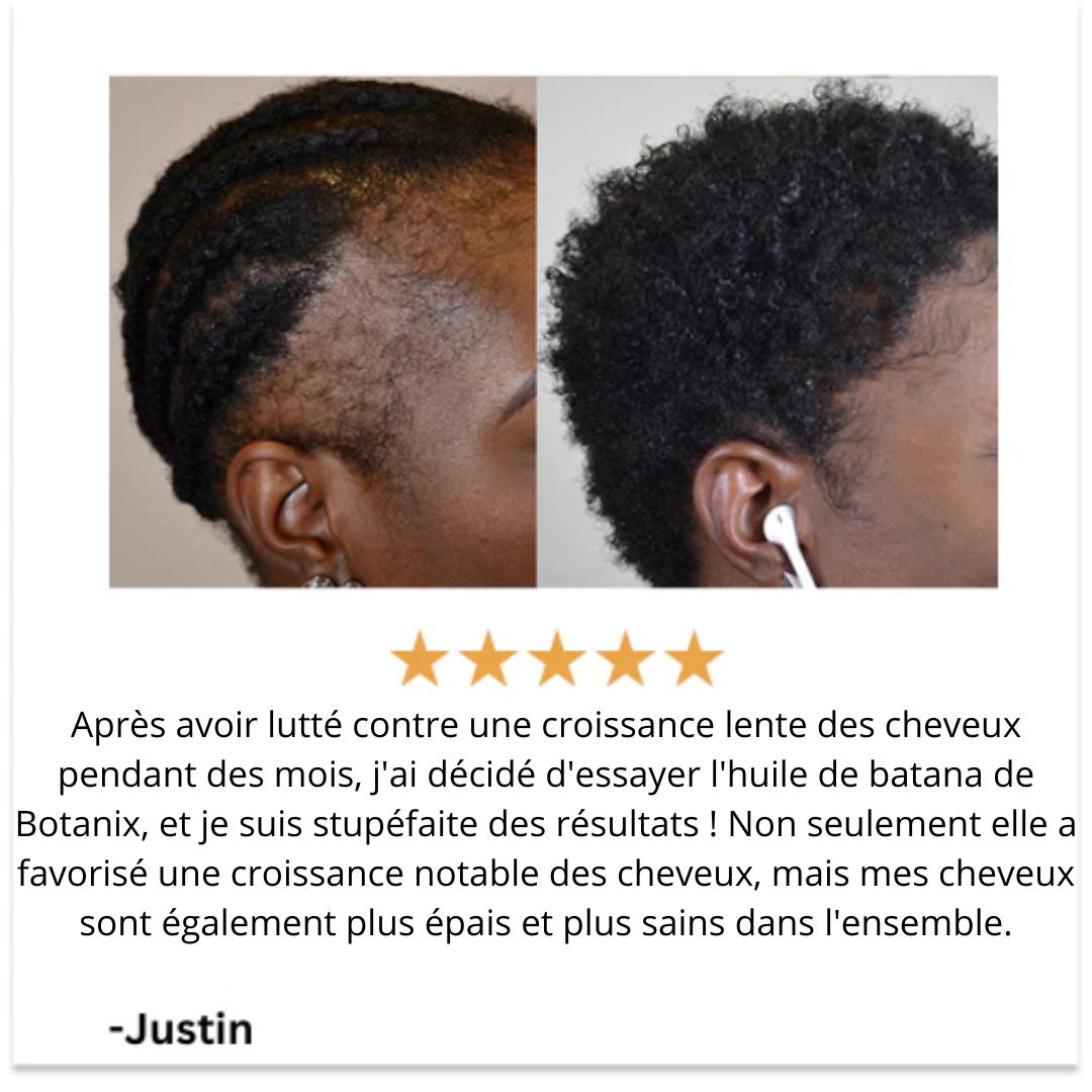 Batana - Huile Naturelle Pour la Croissance des Cheveux